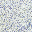 Immunohistochemistry analysis of paraffin-embedded Human tonsil using Phospho-Histone H3-T45 Rabbit pAb (STJ11101034) at dilution of 1:100 (40x lens). Microwave antigen retrieval performed with 0. 01M Tris/EDTA Buffer (pH 9. 0) prior to immunohistochemistry staining.