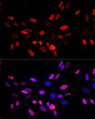 Immunofluorescence analysis of NIH-3T3 cells using Phospho-Histone H3-T45 Rabbit pAb (STJ11101034) at dilution of 100 (40x lens). Secondary antibody: Cy3-conjugated Goat anti-Rabbit IgG (H+L) (STJS001166) at 1:500 dilution. Blue: DAPI for nuclear staining.