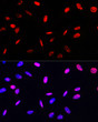 Immunofluorescence analysis of U-2 OS cells using Phospho-Histone H3-T45 Rabbit pAb (STJ11101034) at dilution of 100 (40x lens). Secondary antibody: Cy3-conjugated Goat anti-Rabbit IgG (H+L) (STJS001166) at 1:500 dilution. Blue: DAPI for nuclear staining.