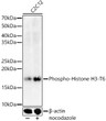 Western blot analysis of lysates from C2C12 cells, using Phospho-Histone H3-T6 Rabbit pAb (STJ11101035) at 1:400 dilution. C2C12 cells were treated by nocodazole (50 ng/ml) at 37 °C for 20 hours. <br/>Secondary antibody: HRP-conjugated Goat anti-Rabbit IgG (H+L) (STJS000856) at 1:10000 dilution. <br/>Lysates/proteins: 25 Mu g per lane. <br/>Blocking buffer: 3% nonfat dry milk in TBST. <br/>Detection: ECL Basic Kit <br/>Exposure time: 90s.