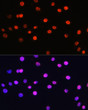 Immunofluorescence analysis of C6 cells using Phospho-Histone H3-T6 Rabbit pAb (STJ11101035) at dilution of 100 (40x lens). Secondary antibody: Cy3-conjugated Goat anti-Rabbit IgG (H+L) (STJS001166) at 1:500 dilution. Blue: DAPI for nuclear staining.