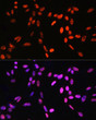 Immunofluorescence analysis of NIH-3T3 cells using Phospho-Histone H3-T6 Rabbit pAb (STJ11101035) at dilution of 100 (40x lens). Secondary antibody: Cy3-conjugated Goat anti-Rabbit IgG (H+L) (STJS001166) at 1:500 dilution. Blue: DAPI for nuclear staining.