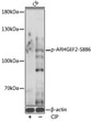 Western blot analysis of lysates from C6 cells, using Phospho-ARHGEF2-S886 Rabbit pAb (STJ11101060) at 1:1000 dilution. C6 were treated by CIP (20ul CIP for each 400ul cell lysate) at 37 °C for 1 hour. <br/>Secondary antibody: HRP-conjugated Goat anti-Rabbit IgG (H+L) (STJS000856) at 1:10000 dilution. <br/>Lysates/proteins: 25 Mu g per lane. <br/>Blocking buffer: 3% BSA. <br/>Detection: ECL Basic Kit <br/>Exposure time: 1s.