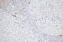 Immunohistochemistry analysis of paraffin-embedded Rat ovary using Phospho-MYL9-T18/S19 Rabbit pAb (STJ11101086) at dilution of 1:100 (20x lens). Microwave antigen retrieval performed with 0. 01M Tris/EDTA Buffer (pH 9. 0) prior to immunohistochemistry staining.