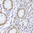 Immunohistochemistry analysis of paraffin-embedded Human appendix using Phospho-c-Abl-Y412 Rabbit pAb (STJ11101098) at dilution of 1:100 (40x lens). Microwave antigen retrieval performed with 0. 01M Tris/EDTA Buffer (pH 9. 0) prior to immunohistochemistry staining.