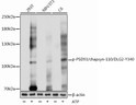 Western blot analysis of various lysates using Phospho-PSD93/chapsyn-110/DLG2-Y340 Rabbit pAb (STJ11101118) at 1:1000 dilution. 293T cells were treated by ATP (5 mM) at 30 °C for 1 hour. NIH/3T3 cells were treated by ATP (5 mM) at 30 °C for 1 hour. C6 cells were treated by ATP (5 mM) at 30 °C for 1 hour. <br/>Secondary antibody: HRP-conjugated Goat anti-Rabbit IgG (H+L) (STJS000856) at 1:10000 dilution. <br/>Lysates/proteins: 25 Mu g per lane. <br/>Blocking buffer: 3% BSA. <br/>Detection: ECL Basic Kit <br/>Exposure time: 1s.