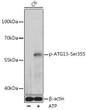 Western blot analysis of lysates from Mouse heart using Phospho-ATG13-Ser355 Rabbit pAb (STJ11101125) at 1:500 dilution incubated overnight at 4 °C. <br/>Secondary antibody: HRP-conjugated Goat anti-Rabbit IgG (H+L) (STJS000856) at 1:10000 dilution. <br/>Lysates/proteins: 25 Mu g per lane. <br/>Blocking buffer: 3% nonfat dry milk in TBST. <br/>Detection: ECL Basic Kit <br/>Exposure time: 60s.