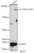 Western blot analysis of lysates from HeLa cells, using Phospho-FOXO1-S319 Rabbit pAb (STJ11101126) at 1:1000 dilution or FOXO1 antibody (STJ115801). HeLa cells were treated by 10% FBS at 37 °C for 30 minutes after serum-starvation overnight. <br/>Secondary antibody: HRP-conjugated Goat anti-Rabbit IgG (H+L) (STJS000856) at 1:10000 dilution. <br/>Lysates/proteins: 25 Mu g per lane. <br/>Blocking buffer: 3% BSA. <br/>Detection: ECL Basic Kit <br/>Exposure time: 10s.