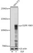 Western blot analysis of lysates from NIH/3T3 cells, using Phospho-EGFR-Y869 Rabbit pAb (STJ11101147) at 1:1000 dilution. NIH/3T3 cells were treated by EGF (100 ng/ml) at 37 °C for 30 minutes after serum-starvation overnight. <br/>Secondary antibody: HRP-conjugated Goat anti-Rabbit IgG (H+L) (STJS000856) at 1:10000 dilution. <br/>Lysates/proteins: 25 Mu g per lane. <br/>Blocking buffer: 3% nonfat dry milk in TBST. <br/>Detection: ECL Basic Kit <br/>Exposure time: 1s.