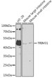 Western blot analysis of various lysates using TRIM31 Rabbit polyclonal antibody (STJ11101162) at 1:1000 dilution. Secondary antibody: HRP Goat Anti-Rabbit IgG (H+L) (STJS000856) at 1:10000 dilution. Lysates/proteins: 25 Mu g per lane. Blocking buffer: 3% nonfat dry milk in TBST. Detection: ECL Basic Kit. Exposure time: 60s.