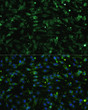 Immunofluorescence analysis of C6 cells using CHRM1 Rabbit polyclonal antibody (STJ11101182) at dilution of 1:100. Secondary antibody: Cy3 Goat Anti-Rabbit IgG (H+L) at 1:500 dilution. Blue: DAPI for nuclear staining.