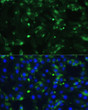 Immunofluorescence analysis of C6 cells using ENO1 antibody (STJ11101183) at dilution of 1:100. Blue: DAPI for nuclear staining.