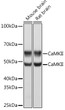 Western blot analysis of various lysates using CaMK2 delta/CAMK2 gamma Rabbit monoclonal antibody (STJ11101232) at 1:1000 dilution. Secondary antibody: HRP Goat Anti-Rabbit IgG (H+L) (STJS000856) at 1:10000 dilution. Lysates/proteins: 25 Mu g per lane. Blocking buffer: 3% nonfat dry milk in TBST. Detection: ECL Basic Kit. Exposure time: 5s. Western blot analysis of various lysates using CaMK2 delta/CAMK2 gamma Rabbit monoclonal antibody (STJ11101232) at 1:1000 dilution. Secondary antibody: HRP Goat Anti-Rabbit IgG (H+L) (STJS000856) at 1:10000 dilution. Lysates/proteins: 25 Mu g per lane. Blocking buffer: 3% nonfat dry milk in TBST. Detection: ECL Basic Kit. Exposure time: 5s.