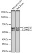 Western blot analysis of extracts of various cell lines, using CaMKII rabbit monoclonal antibody (STJ11101233) at 1:1000 dilution. Secondary antibody: HRP Goat Anti-rabbit IgG (H+L) (STJS000856) at 1:10000 dilution. Lysates/proteins: 25 Mu g per lane. Blocking buffer: 3% non-fat dry milk in TBST. Detection: ECL Basic Kit. Exposure time: 5s.