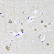 Immunohistochemistry analysis of paraffin-embedded human brain using Matrin 3 Rabbit monoclonal antibody (STJ11101266) at dilution of 1:100 (40x lens). Perform microwave antigen retrieval with 10 mM Tris/EDTA buffer pH 9. 0 before commencing with immunohistochemistry staining protocol.