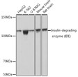 Western blot analysis of extracts of various cell lines, using Insulin-degrading enzyme (Insulin-degrading enzyme (IDE) ) Rabbit monoclonal antibody (STJ11101287) at 1：1000 dilution. Secondary antibody: HRP Goat Anti-Rabbit IgG (H+L) (STJS000856) at 1:10000 dilution. Lysates/proteins: 25 Mu g per lane. Blocking buffer: 3% nonfat dry milk in TBST. Detection: ECL Basic Kit. Exposure time: 1s.