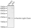 Western blot analysis of various lysates, using Ferritin Light Chain antibody (STJ11101302) at 1:8000 dilution. Secondary antibody: HRP Goat Anti-rabbit IgG (H+L) (STJS000856) at 1:10000 dilution. Lysates/proteins: 25 Mu g per lane. Blocking buffer: 3% non-fat dry milk in TBST. Detection: ECL Basic Kit. Exposure time: 180s.