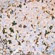 Immunohistochemistry analysis of Ferritin Light Chain in paraffin-embedded human tonsil tissue using Ferritin Light Chain rabbit monoclonal antibody (STJ11101302) at a dilution of 1:400 (40x lens). High pressure antigen retrieval was performed with 0. 01 M citrate buffer (pH 6. 0) prior to immunohistochemistry staining.