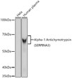 Western blot analysis of extracts of various cell lines, using Alpha-1 Antichymotrypsin (SERPINA3) Rabbit monoclonal antibody (STJ11101318) at 1:1000 dilution. Secondary antibody: HRP Goat Anti-Rabbit IgG (H+L) (STJS000856) at 1:10000 dilution. Lysates/proteins: 25 Mu g per lane. Blocking buffer: 3% nonfat dry milk in TBST. Detection: ECL Basic Kit. Exposure time: 30s.