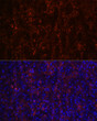Immunofluorescence analysis of human spleen using CD23 Rabbit monoclonal antibody (STJ11101330) at dilution of 1:100 (40x lens). Blue: DAPI for nuclear staining.