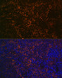 Immunofluorescence analysis of rat spleen using CD23 Rabbit monoclonal antibody (STJ11101330) at dilution of 1:100 (40x lens). Blue: DAPI for nuclear staining.
