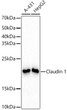 Western blot analysis of various lysates, using Claudin 1 rabbit monoclonal antibody (STJ11101351) at 1:2000 dilution. Secondary antibody: HRP Goat Anti-rabbit IgG (H+L) (STJS000856) at 1:10000 dilution. Lysates/proteins: 25 Mu g per lane. Blocking buffer: 3% non-fat dry milk in TBST. Detection: ECL Basic Kit. Exposure time: 1s.