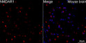 Confocal imaging of Mouse brain using NMDAR1 Rabbit monoclonal antibody (STJ11101394, dilution 1:100) (Red). DAPI was used for nuclear staining (blue). Objective: 60x.