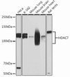 Western blot analysis of extracts of various cell lines, using HDAC7 Rabbit monoclonal antibody (STJ11101421) at 1：1000 dilution. Secondary antibody: HRP Goat Anti-Rabbit IgG (H+L) (STJS000856) at 1:10000 dilution. Lysates/proteins: 25 Mu g per lane. Blocking buffer: 3% nonfat dry milk in TBST. Detection: ECL Basic Kit. Exposure time: 60s.