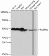 Western blot analysis of extracts of various cell lines, using PABPN1 rabbit monoclonal antibody (STJ11101447) at 1:1000 dilution. Secondary antibody: HRP Goat Anti-rabbit IgG (H+L) (STJS000856) at 1:10000 dilution. Lysates/proteins: 25 Mu g per lane. Blocking buffer: 3% non-fat dry milk in TBST. Detection: ECL Basic Kit. Exposure time: 10s.