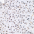 Immunohistochemistry analysis of PABPN1 in paraffin-embedded mouse liver tissue using PABPN1 rabbit monoclonal antibody (STJ11101447) at a dilution of 1:200 (40x lens). High pressure antigen retrieval was performed with 0. 01 M citrate buffer (pH 6. 0) prior to immunohistochemistry staining.