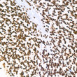 Immunohistochemistry analysis of PABPN1 in paraffin-embedded rat brain tissue using PABPN1 rabbit monoclonal antibody (STJ11101447) at a dilution of 1:200 (40x lens). High pressure antigen retrieval was performed with 0. 01 M citrate buffer (pH 6. 0) prior to immunohistochemistry staining.