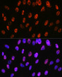 Immunofluorescence analysis of C6 cells using PABPN1 rabbit monoclonal antibody (STJ11101447) at dilution of 1:100 (40x lens). Blue: DAPI for nuclear staining.