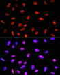 Immunofluorescence analysis of U-2 OS cells using PABPN1 rabbit monoclonal antibody (STJ11101447) at dilution of 1:100 (40x lens). Blue: DAPI for nuclear staining.