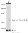 Western blot analysis of lysates from MCF7 cells, using Lactic acid-Histone H3-K18 Rabbit polyclonal antibody (STJ11101498) at 1:500 dilution. MCF7 cells were treated by Sodium lactate (100mM) for 24h. Secondary antibody: HRP Goat Anti-Rabbit IgG (H+L) (STJS000856) at 1:10000 dilution. Lysates/proteins: 25 Mu g per lane. Blocking buffer: 3% BSA. Detection: ECL Basic Kit. Exposure time: 5min.