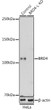Western blot analysis of lysates from wild type (WT) and BRD4 knockout (KO) HeLa cells, using [KO Validated] BRD4 Rabbit polyclonal antibody (STJ11101529) at 1:500 dilution. Secondary antibody: HRP Goat Anti-Rabbit IgG (H+L) (STJS000856) at 1:10000 dilution. Lysates/proteins: 25 Mu g per lane. Blocking buffer: 3% nonfat dry milk in TBST. Detection: ECL Enhanced Kit. Exposure time: 300s.