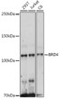 Western blot analysis of various lysates using [KO Validated] BRD4 Rabbit polyclonal antibody (STJ11101529) at 1:500 dilution. Secondary antibody: HRP Goat Anti-Rabbit IgG (H+L) (STJS000856) at 1:10000 dilution. Lysates/proteins: 25 Mu g per lane. Blocking buffer: 3% nonfat dry milk in TBST. Detection: ECL Enhanced Kit. Exposure time: 300s.