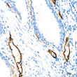 Immunohistochemistry analysis of paraffin-embedded Human prostate tissue using CD105/Endoglin Rabbit monoclonal antibody (STJ11101546) at a dilution of 1:10000 (40x lens). High pressure antigen retrieval performed with 0. 01M Tris-EDTA Buffer (pH 9. 0) prior to immunohistochemistry staining.