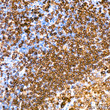 Immunohistochemistry analysis of paraffin-embedded human tonsil using CD79a Rabbit monoclonal antibody (STJ11101562) at dilution of 1:400 (40x lens). Perform high pressure antigen retrieval with 10 mM citrate buffer pH 6. 0 before commencing with immunohistochemistry staining protocol.