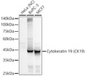 Western blot analysis of various lysates, using Cytokeratin 19 (CK19) Rabbit monoclonal antibody (STJ11101578) at 1:500 dilution. Secondary antibody: HRP Goat Anti-Rabbit IgG (H+L) (STJS000856) at 1:10000 dilution. Lysates/proteins: 25 Mu g per lane. Blocking buffer: 3% nonfat dry milk in TBST. Detection: ECL Basic Kit. Negative control (NC) : HeLaExposure time: 0. 5s.