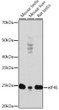 Western blot analysis of various lysates using eIF4E Rabbit monoclonal antibody (STJ11101582) at 1:1000 dilution. Secondary antibody: HRP Goat Anti-Rabbit IgG (H+L) (STJS000856) at 1:10000 dilution. Lysates/proteins: 25 Mu g per lane. Blocking buffer: 3% nonfat dry milk in TBST. Detection: ECL Enhanced Kit. Exposure time: 3min.
