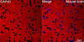 Confocal imaging of paraffin-embedded Mouse brain tissue using GAP43 Rabbit monoclonal antibody (STJ11101593, dilution 1:200) followed by a further incubation with Cy3 Goat Anti-Rabbit IgG (H+L) ( dilution 1:500) (Red). DAPI was used for nuclear staining (Blue). Objective: 40x. Perform microwave antigen retrieval with 0. 01 M citrate buffer (pH 6. 0) prior to IF staining.