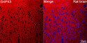 Confocal imaging of paraffin-embedded Rat brain tissue using GAP43 Rabbit monoclonal antibody (STJ11101593, dilution 1:200) followed by a further incubation with Cy3 Goat Anti-Rabbit IgG (H+L) ( dilution 1:500) (Red). DAPI was used for nuclear staining (Blue). Objective: 40x. Perform microwave antigen retrieval with 0. 01 M citrate buffer (pH 6. 0) prior to IF staining.