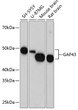 Western blot analysis of various lysates using GAP43 Rabbit monoclonal antibody (STJ11101593) at 1:1000 dilution. Secondary antibody: HRP Goat Anti-Rabbit IgG (H+L) (STJS000856) at 1:10000 dilution. Lysates/proteins: 25 Mu g per lane. Blocking buffer: 3% nonfat dry milk in TBST. Detection: ECL Basic Kit. Exposure time: 10s.