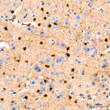 Immunohistochemistry analysis of paraffin-embedded mouse brain using GST3/GSTP1 rabbit monoclonal antibody (STJ11101599) at dilution of 1:200 (40x lens). Perform high pressure antigen retrieval with 10 mM citrate buffer pH 6. 0 before commencing with immunohistochemistry staining protocol.