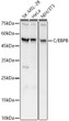 Western blot analysis of various lysates, using C/EBPB antibody (STJ111016) at 1:700 dilution. Secondary antibody: HRP Goat Anti-Rabbit IgG (H+L) (STJS000856) at 1:10000 dilution. Lysates/proteins: 25 Mu g per lane. Blocking buffer: 3% nonfat dry milk in TBST. Detection: ECL Basic Kit. Exposure time: 1s.