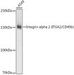 Western blot analysis of lysates from A549 cells, using [KO Validated] Integrin alpha 2 (ITGA2/CD49b) Rabbit monoclonal antibody (STJ11101605) at 1:1000 dilution. Secondary antibody: HRP Goat Anti-Rabbit IgG (H+L) (STJS000856) at 1:10000 dilution. Lysates/proteins: 25 Mu g per lane. Blocking buffer: 3% nonfat dry milk in TBST. Detection: ECL Basic Kit. Exposure time: 1s.