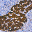 Immunohistochemistry analysis of paraffin-embedded human pancreas using PGP9. 5/UCHL1 rabbit monoclonal antibody (STJ11101638) at dilution of 1:1000 (40x lens). Perform high pressure antigen retrieval with 10 mM citrate buffer pH 6. 0 before commencing with immunohistochemistry staining protocol.
