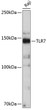 Western blot analysis of extracts of Raji cells, using TLR7 antibody (STJ11101663) at 1:500 dilution. Secondary antibody: HRP Goat Anti-Rabbit IgG (H+L) (STJS000856) at 1:10000 dilution. Lysates/proteins: 25 Mu g per lane. Blocking buffer: 3% nonfat dry milk in TBST. Detection: ECL Basic Kit. Exposure time: 3min.