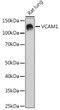 Western blot analysis of lysates from Rat lung, using VCAM1 Rabbit monoclonal antibody (STJ11101668) at 1:1000 dilution. Secondary antibody: HRP Goat Anti-Rabbit IgG (H+L) (STJS000856) at 1:10000 dilution. Lysates/proteins: 25 Mu g per lane. Blocking buffer: 3% nonfat dry milk in TBST. Detection: ECL Basic Kit. Exposure time: 3min.