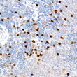 Immunohistochemistry analysis of Aurora B in paraffin-embedded rat spleen tissue using Aurora B Rabbit monoclonal antibody (STJ11101686) at a dilution of 1:500 (40x lens). High pressure antigen retrieval was performed with 0. 01 M citrate buffer (pH 6. 0) prior to immunohistochemistry staining.